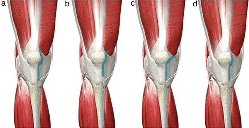 cot-rodilla-16